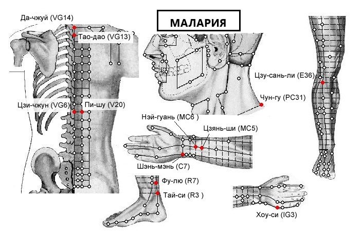 МАЛАРИЯ | ЕЛЕКТРОПУНКТУРА