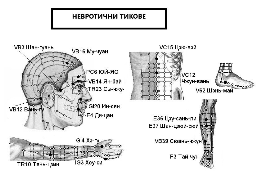НЕВРОТИЧНИ ТИКОВЕ | ЕЛЕКТРОПУНКТУРА