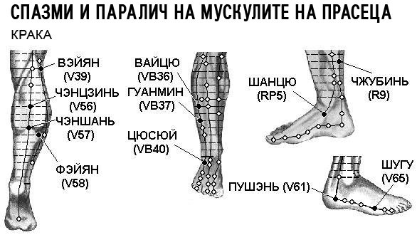 СПАЗМИ И ПАРАЛИЧ НА МУСКУЛИТЕ НА ПРАСЕЦА | ЕЛЕКТРОПУНКТУРА