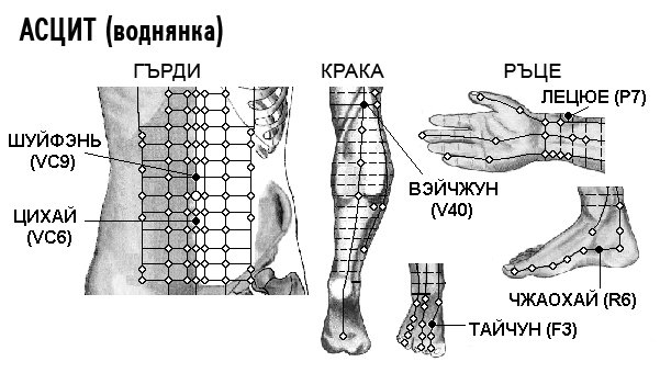 АСЦИТ | ЕЛЕКТРОПУНКТУРА