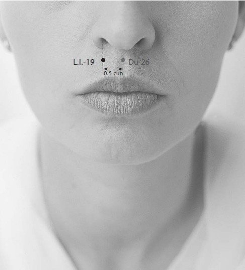 GI19 ХЪЛЯО ЗЛАЧНО ЛОЖЕ | ЕЛЕКТРОПУНКТУРА
