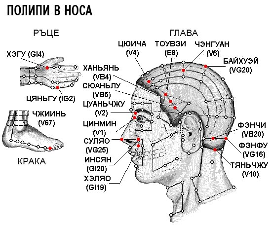ПОЛИПИ В НОСА | ЕЛЕКТРОПУНКТУРА