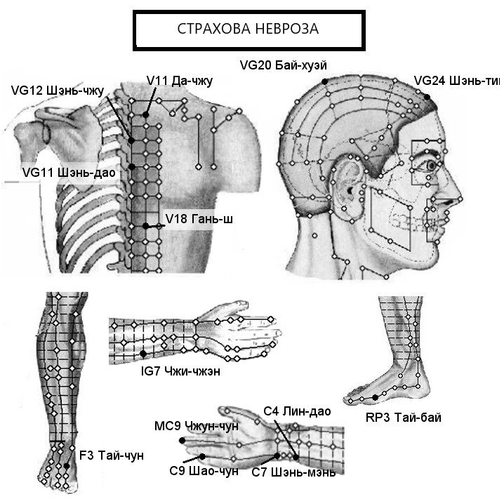 СТРАХОВА НЕВРОЗА | ЕЛЕКТРОПУНКТУРА