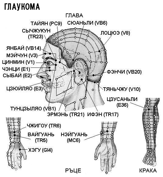 ГЛАУКОМА | ЕЛЕКТРОПУНКТУРА