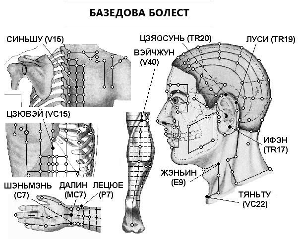 БАЗЕДОВА БОЛЕСТ