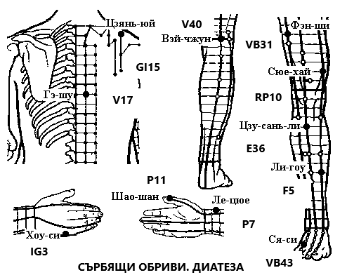 ДИАТЕЗА | ЕЛЕКТРОПУНКТУРА