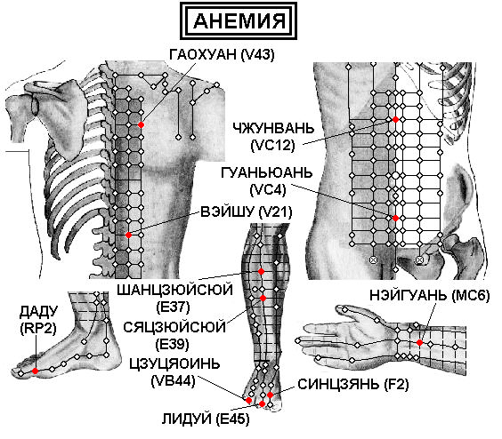 АНЕМИЯ | ЕЛЕКТРОПУНКТУРА