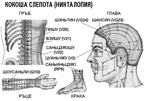 КОКОША СЛЕПОТА / НИКТАЛОПИЯ | ЕЛЕКТРОПУНКТУРА