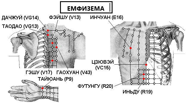 ЕМФИЗЕМ | ЕЛЕКТРОПУНКТУРА