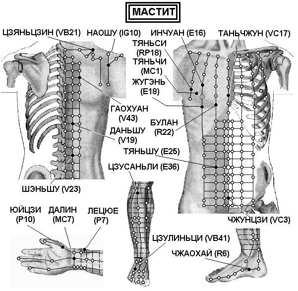 МАСТИТ | ЕЛЕКТРОПУНКТУРА