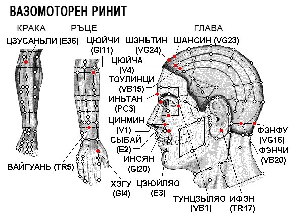 ВАЗОМОТОРЕН РИНИТ | ЕЛЕКТРОПУНКТУРА