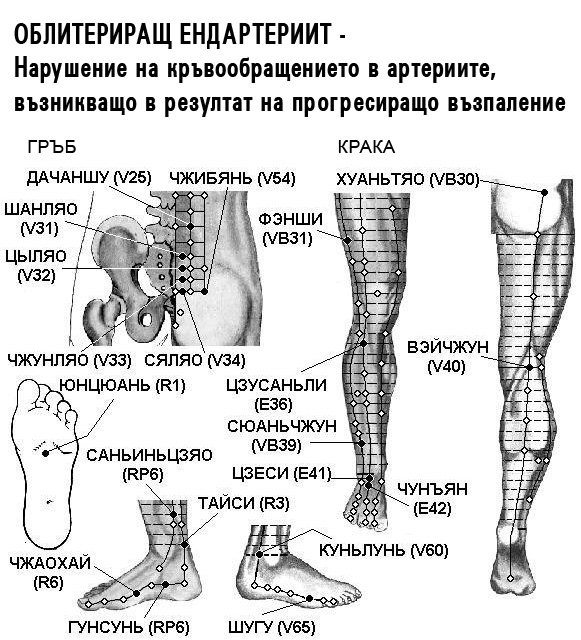 ОБЛИТИРАЩ ЕНДАРТЕРИИТ | ЕЛЕКТРОПУНКТУРА