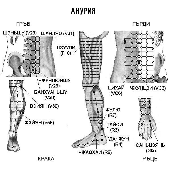 АНУРИЯ | ЕЛЕКТРОПУНКТУРА