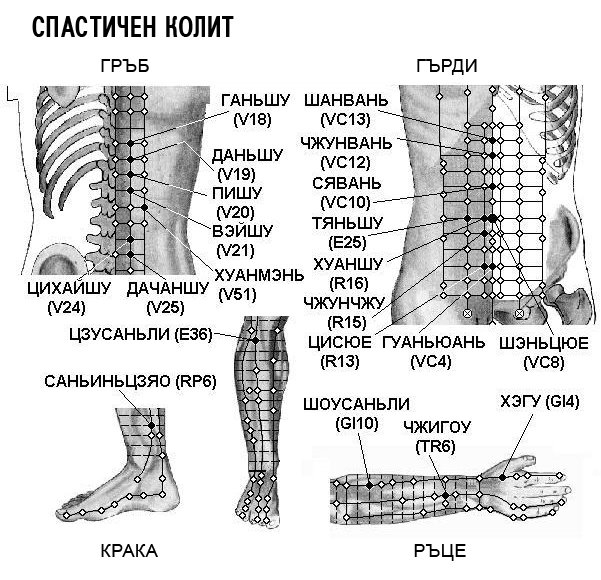 СПАСТИЧЕН КОЛИТ | ЕЛЕКТРОПУНКТУРА