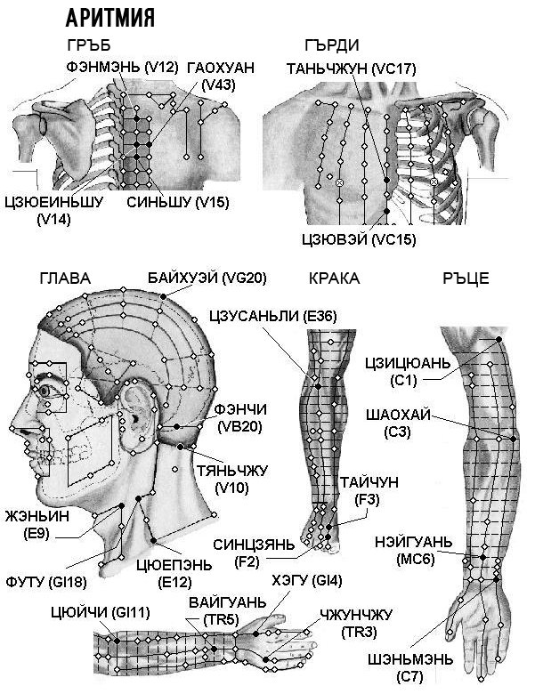 АРИТМИЯ | ЕЛЕКТРОПУНКТУРА