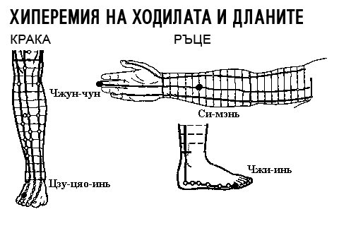 ХИПЕРЕМИЯ НА ХОДИЛАТА И ДЛАНИТЕ | ЕЛЕКТРОПУНКТУРА