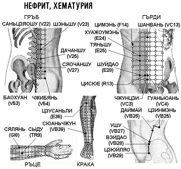 НЕФРИТ, ХЕМАТУРИЯ | ЕЛЕКТРОПУНКТУРА