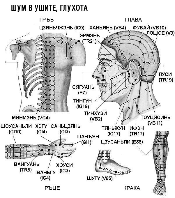ШУМ В УШИТЕ, ГЛУХОТА | ЕЛЕКТРОПУНКТУРА