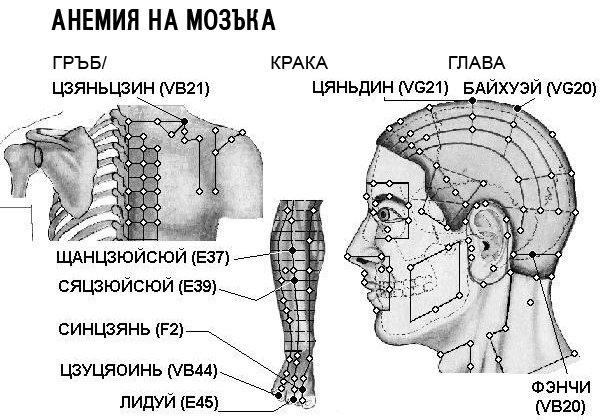 АНЕМИЯ НА МОЗЪКА | ЕЛЕКТРОПУНКТУРА