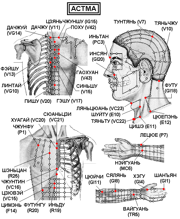 АСТМА | ЕЛЕКТРОПУНКТУРА