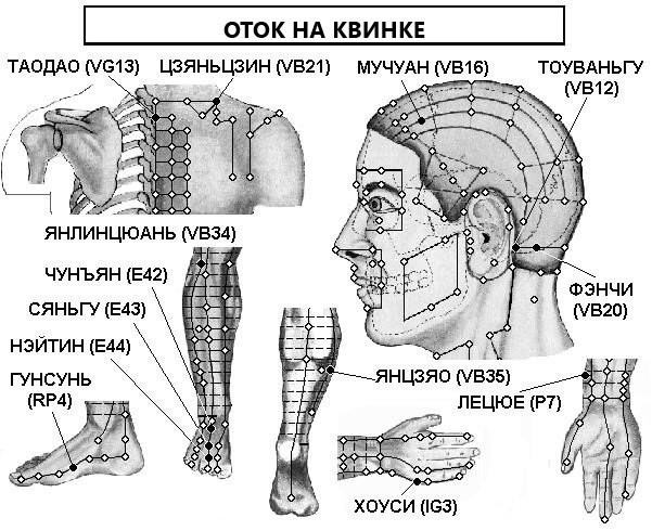 ОТОК НА КВИНКЕ | ЕЛЕКТРОПУНКТУРА
