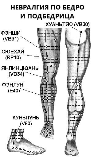 НЕВРАЛГИЯ ПО БЕДРО И ПОДБЕДРИЦА | ЕЛЕКТРОПУНКТУРА