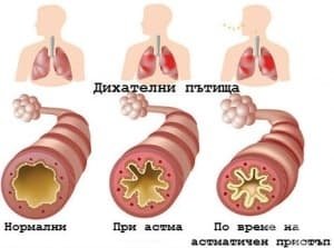 АСТМА | ЕЛЕКТРОПУНКТУРА
