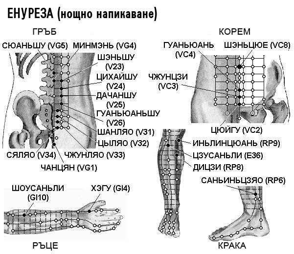 ЕНУРЕЗА | ЕЛЕКТРОПУНКТУРА