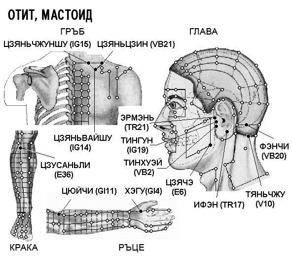 ОТИТ, МАСТОИДИТ | ЕЛЕКТРОПУНКТУРА