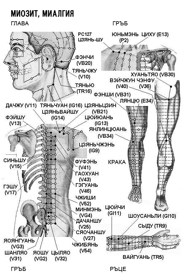 МИОЗИТ, МИЛАГИЯ | ЕЛЕКТРОПУНКТУРА