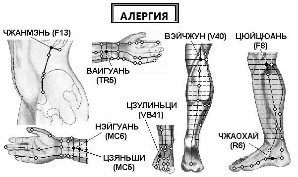 АЛЕРГИЯ | ЕЛЕКТРОПУНКТУРА