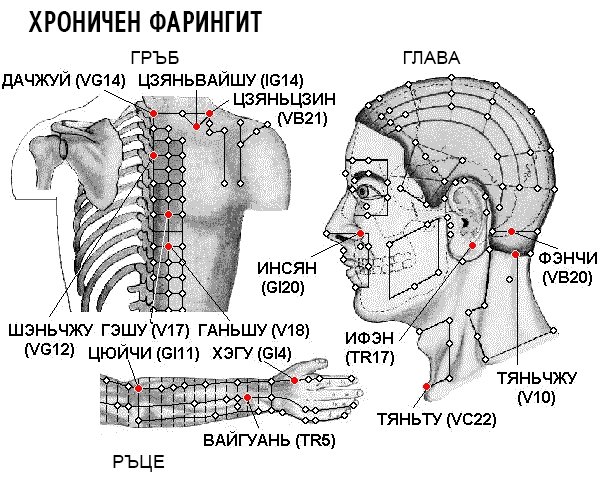 ХРОНИЧЕН ФАРИНГИТ | ЕЛЕКТРОПУНКТУРА