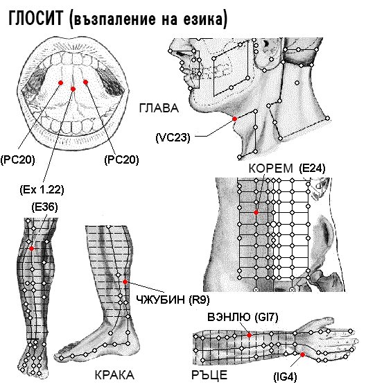 ГЛОСИТ | ЕЛЕКТРОПУНКТУРА