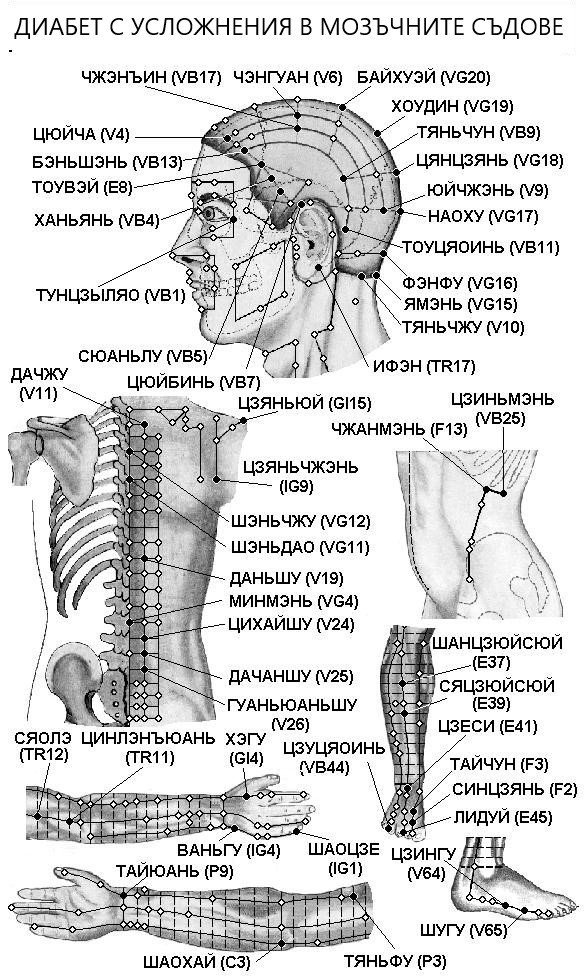 ДИАБЕТ С УСЛОЖНЕНИЯ В МОЗЪЧНИТЕ СЪДОВЕ