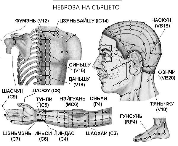 НЕВРОЗА НА СЪРЦЕТО | ЕЛЕКТРОПУНКТУРА