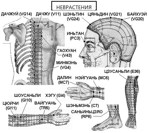 НЕВРАСТЕНИЯ | ЕЛЕКТРОПУНКТУРА