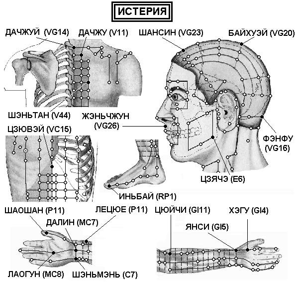 ИСТЕРИЯ | ЕЛЕКТРОПУНКТУРА