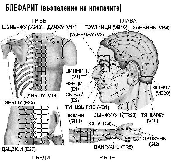 БЛЕФАРИТ | ЕЛЕКТРОПУНКТУРА