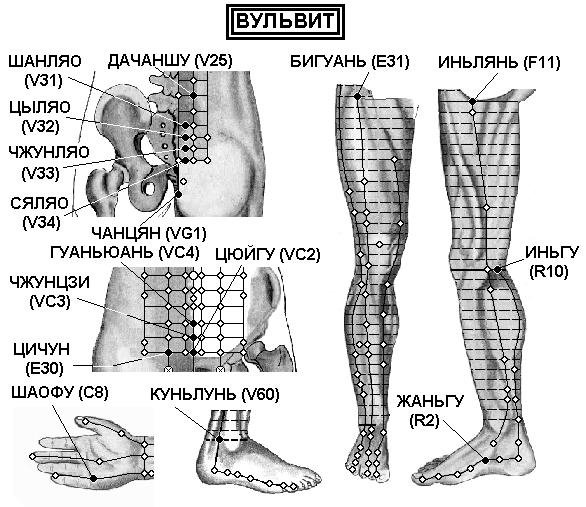 ВУЛВИТ | ЕЛЕКТРОПУНКТУРА