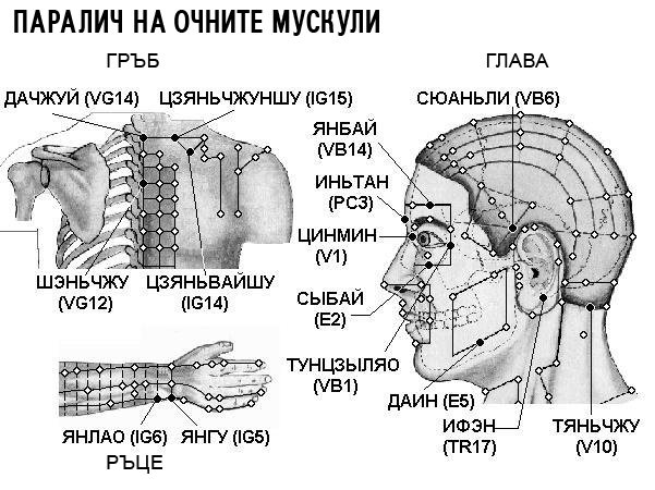 ПАРАЛИЧ НА ОЧНИТЕ МУСКУЛИ | ЕЛЕКТРОПУНКТУРА