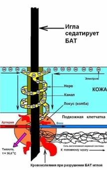 ЕЛЕКТРОНЕН ЛЕЧЕБНО-ДИАГНОСТИЧЕН АПАРАТ "ЕЛЕДИА" | ЕЛЕКТРОПУНКТУРА