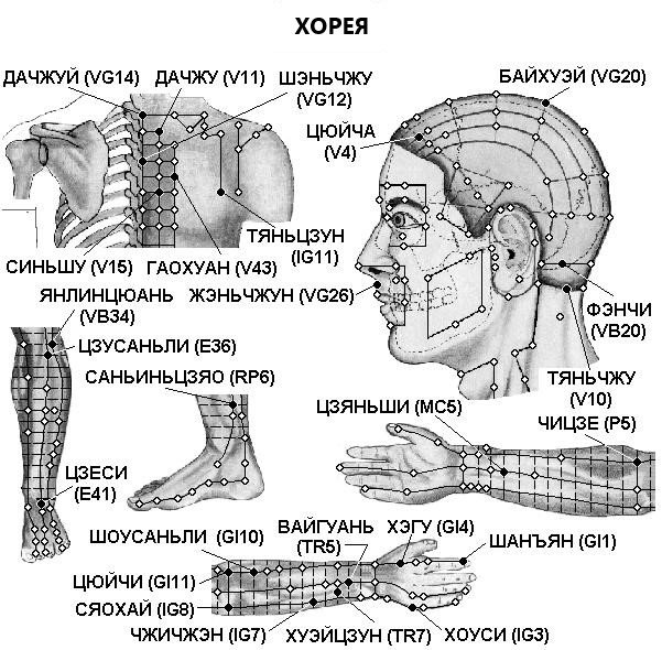 ХОРЕЯ | ЕЛЕКТРОПУНКТУРА