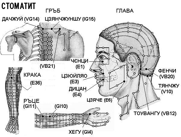 СТОМАТИТ | ЕЛЕКТРОПУНКТУРА