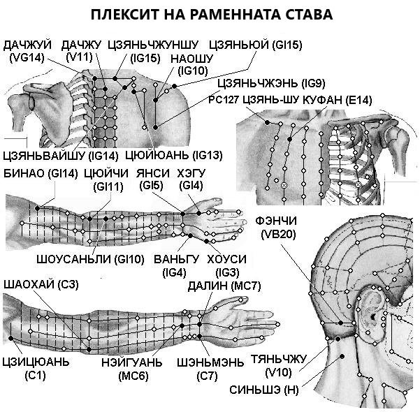 ПЛЕКСИТ НА РАМЕННАТА СТАВА | ЕЛЕКТРОПУНКТУРА
