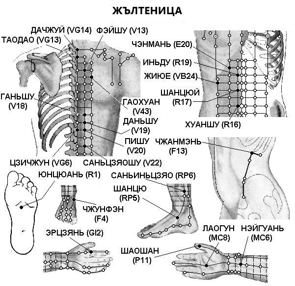ЖЪЛТЕНИЦА | ЕЛЕКТРОПУНКТУРА