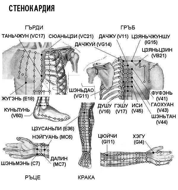 СТЕНОКАРДИЯ | ЕЛЕКТРОПУНКТУРА