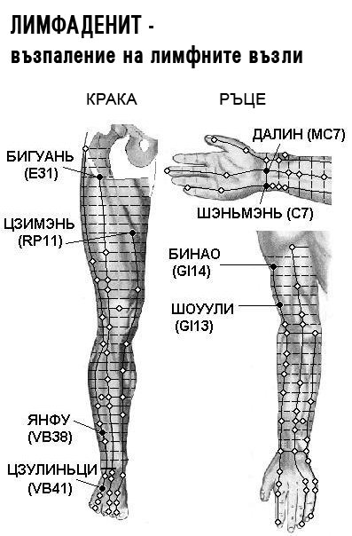 ЛИМФАДЕНИТ | ЕЛЕКТРОПУНКТУРА