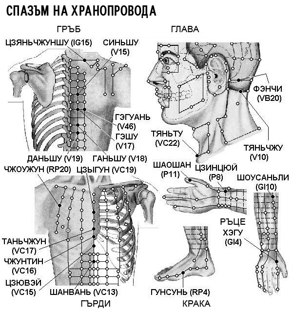 СПАЗЪМ НА ХРАНОПРОВОДА | ЕЛЕКТРОПУНКТУРА
