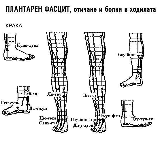 ПЛАНТАРЕН ФАСЦИТ | ЕЛЕКТРОПУНКТУРА