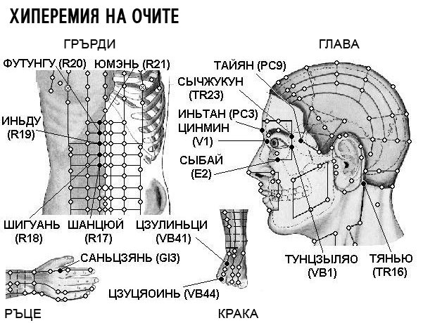 ХИПЕРЕМИЯ НА ОЧИТЕ | ЕЛЕКТРОПУНКТУРА